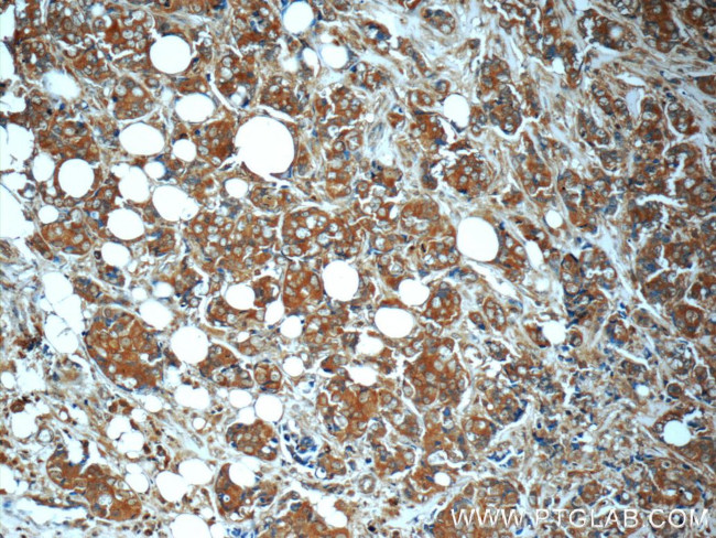 MN1 Antibody in Immunohistochemistry (Paraffin) (IHC (P))