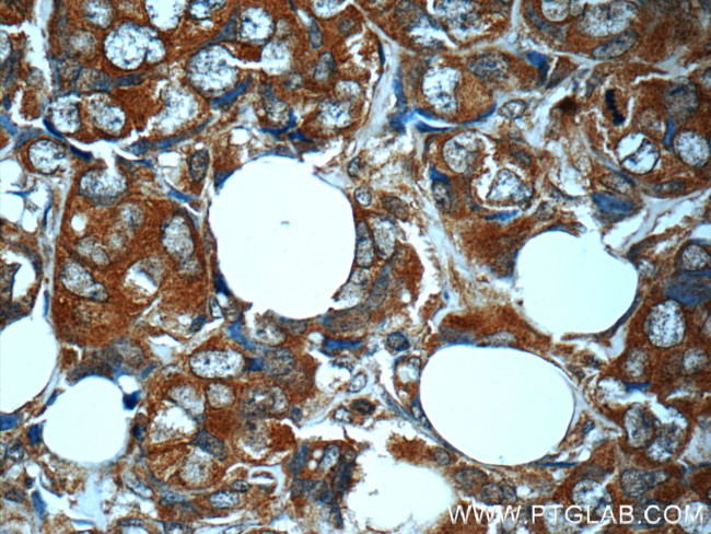 MN1 Antibody in Immunohistochemistry (Paraffin) (IHC (P))