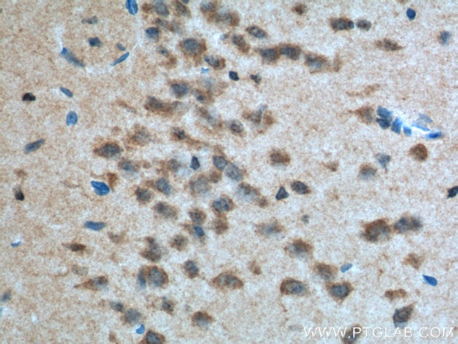 PVRL1 Antibody in Immunohistochemistry (Paraffin) (IHC (P))