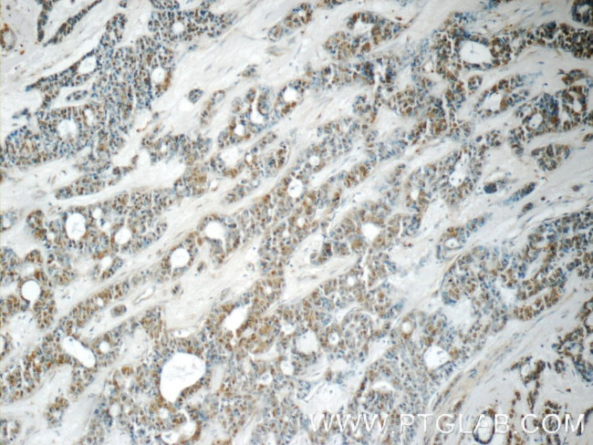 YEATS2 Antibody in Immunohistochemistry (Paraffin) (IHC (P))