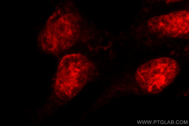 MDC1 Antibody in Immunocytochemistry (ICC/IF)