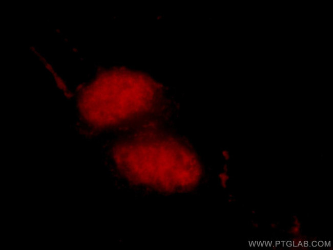 MDC1 Antibody in Immunocytochemistry (ICC/IF)