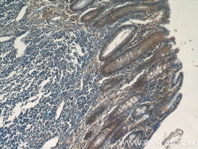 MDC1 Antibody in Immunohistochemistry (Paraffin) (IHC (P))