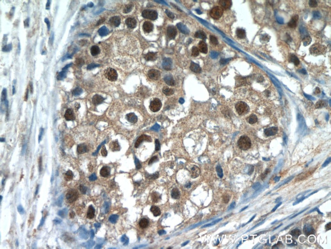 MDC1 Antibody in Immunohistochemistry (Paraffin) (IHC (P))