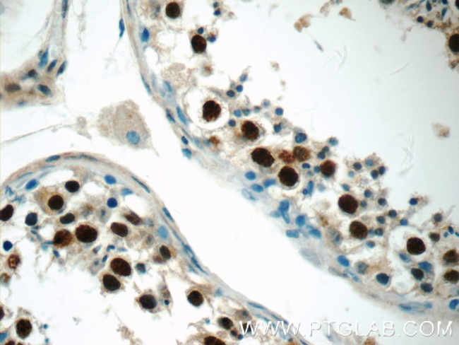 MDC1 Antibody in Immunohistochemistry (Paraffin) (IHC (P))