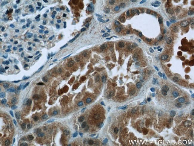 EFTUD1 Antibody in Immunohistochemistry (Paraffin) (IHC (P))