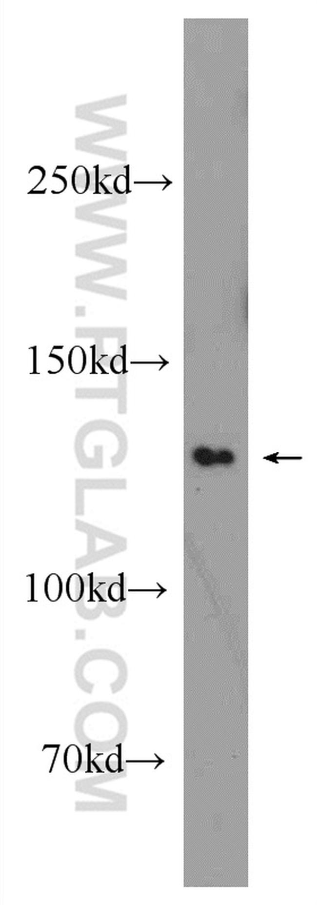 EFTUD1 Antibody in Western Blot (WB)