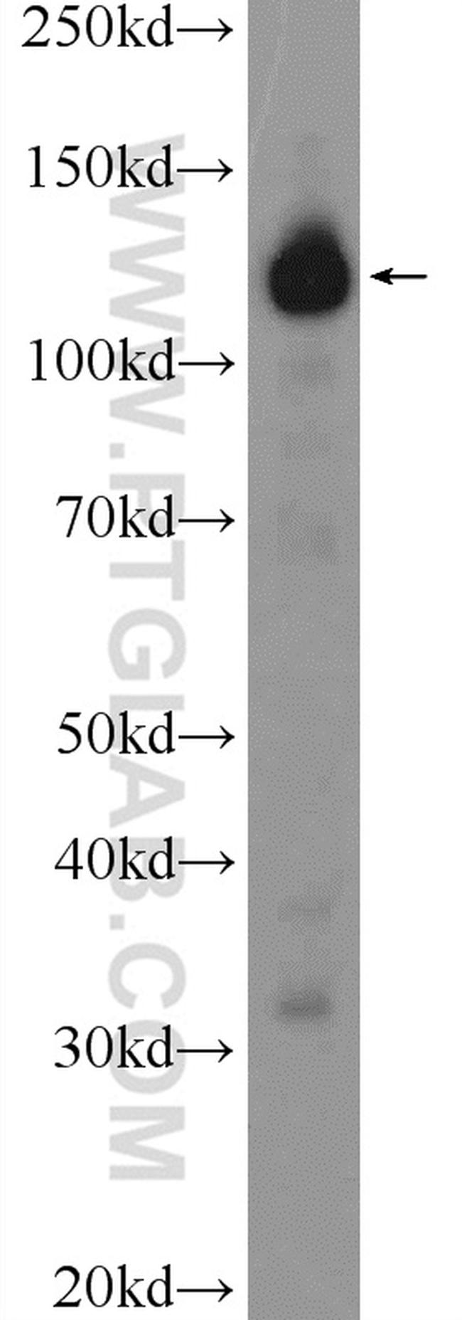 EFTUD1 Antibody in Western Blot (WB)