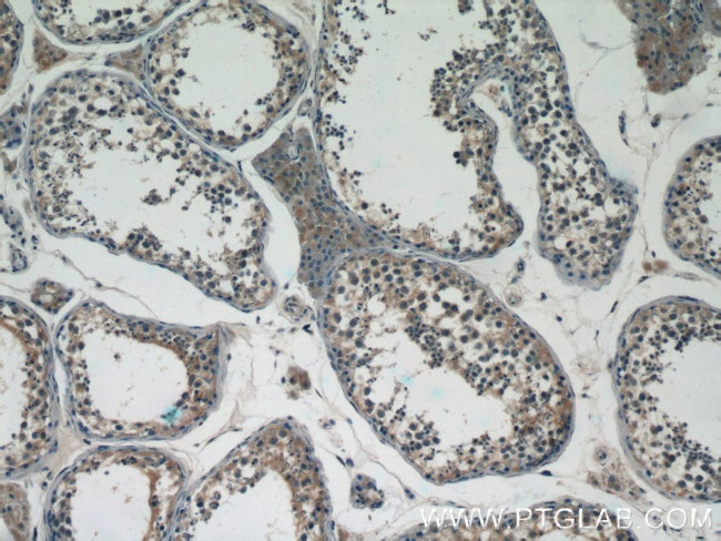 BTBD16 Antibody in Immunohistochemistry (Paraffin) (IHC (P))