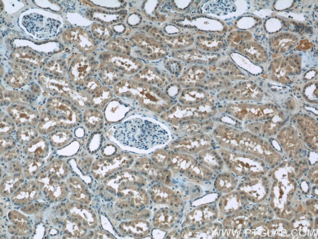 BTBD16 Antibody in Immunohistochemistry (Paraffin) (IHC (P))