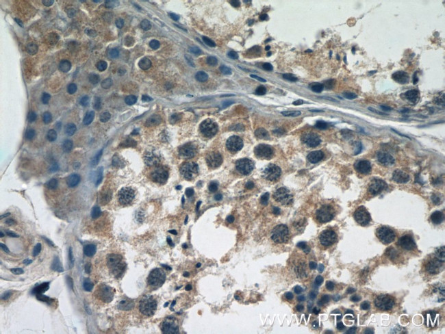 BTBD16 Antibody in Immunohistochemistry (Paraffin) (IHC (P))