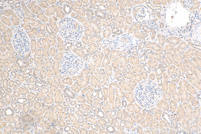 BTBD16 Antibody in Immunohistochemistry (Paraffin) (IHC (P))