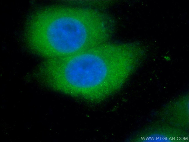 VHL Antibody in Immunocytochemistry (ICC/IF)