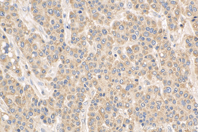 VHL Antibody in Immunohistochemistry (Paraffin) (IHC (P))