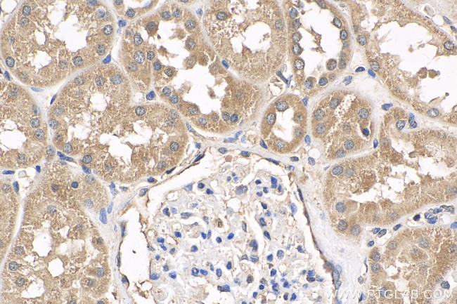 VHL Antibody in Immunohistochemistry (Paraffin) (IHC (P))