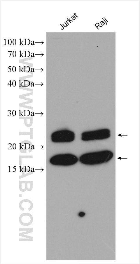 VHL Antibody in Western Blot (WB)