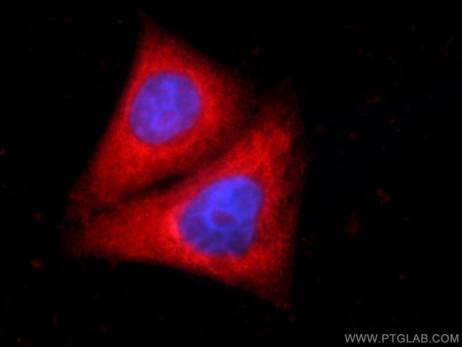 SMC4 Antibody in Immunocytochemistry (ICC/IF)