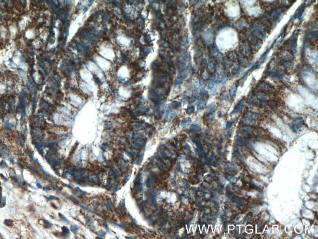 SMC4 Antibody in Immunohistochemistry (Paraffin) (IHC (P))