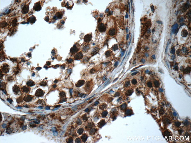 SMC4 Antibody in Immunohistochemistry (Paraffin) (IHC (P))