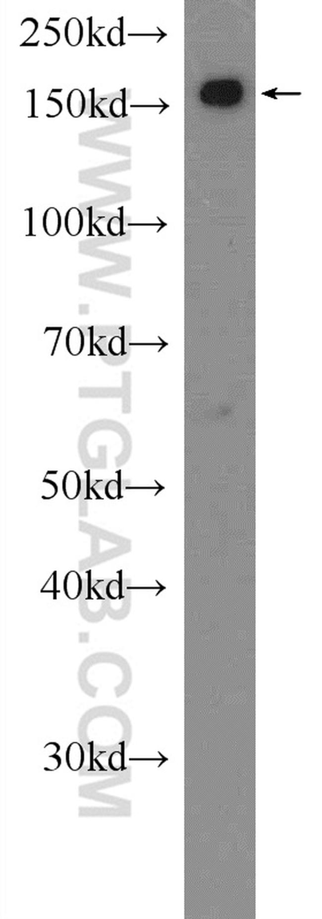 SMC4 Antibody in Western Blot (WB)