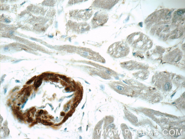 Calponin 1 Antibody in Immunohistochemistry (Paraffin) (IHC (P))