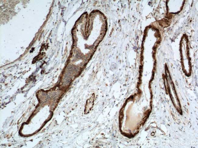 Calponin 1 Antibody in Immunohistochemistry (Paraffin) (IHC (P))