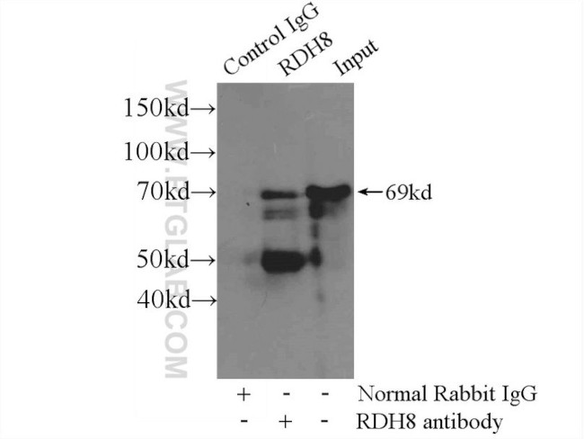 FUBP1 Antibody in Immunoprecipitation (IP)