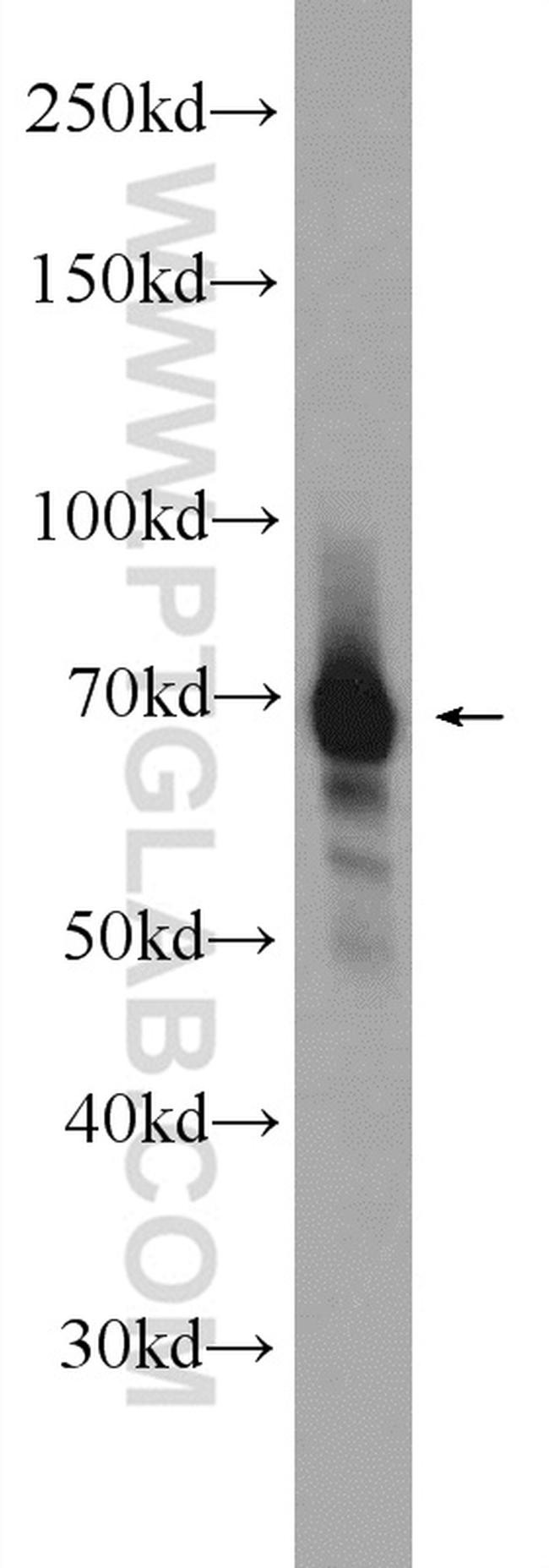 FUBP1 Antibody in Western Blot (WB)