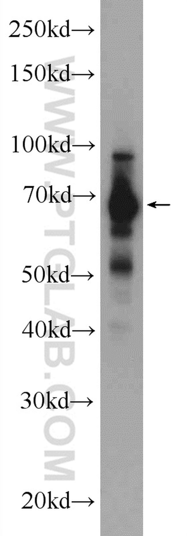 FUBP1 Antibody in Western Blot (WB)