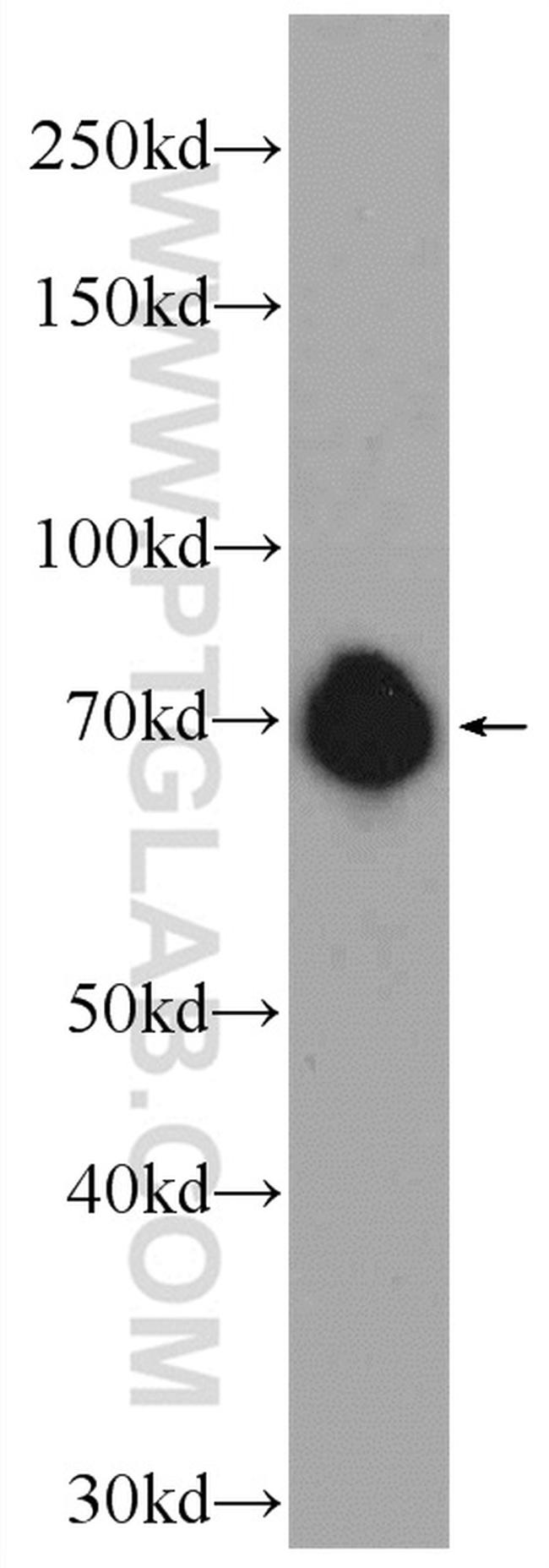 FUBP1 Antibody in Western Blot (WB)