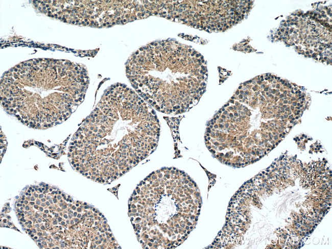 PLEKHO1 Antibody in Immunohistochemistry (Paraffin) (IHC (P))