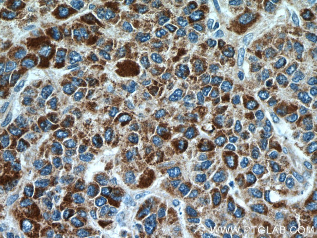 CYP7B1 Antibody in Immunohistochemistry (Paraffin) (IHC (P))