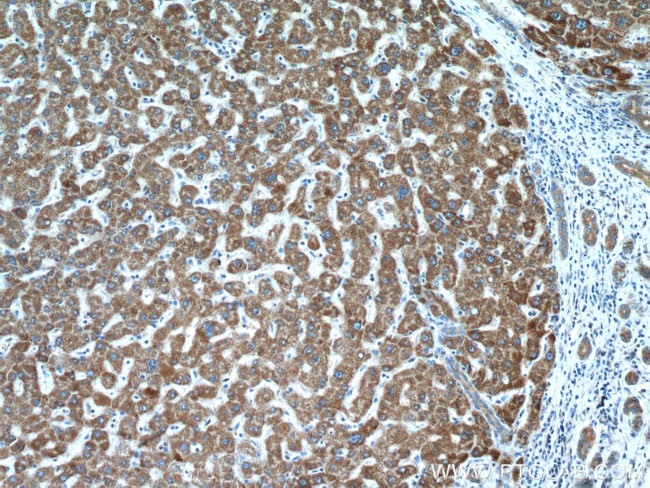 CYP7B1 Antibody in Immunohistochemistry (Paraffin) (IHC (P))