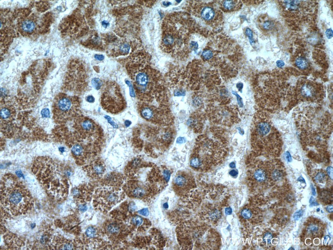 CYP7B1 Antibody in Immunohistochemistry (Paraffin) (IHC (P))