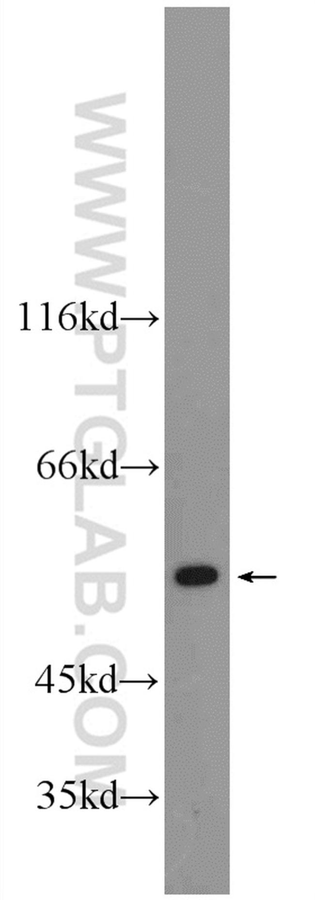 CYP7B1 Antibody in Western Blot (WB)