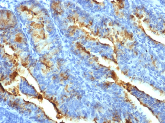 FSH-Receptor Antibody in Immunohistochemistry (Paraffin) (IHC (P))