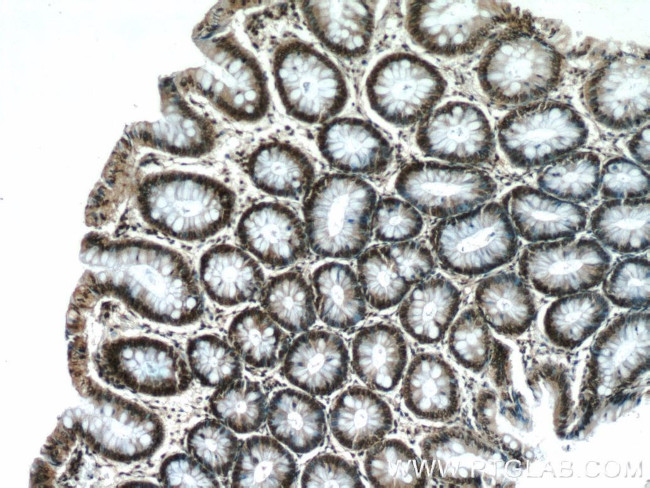 HIC1 Antibody in Immunohistochemistry (Paraffin) (IHC (P))