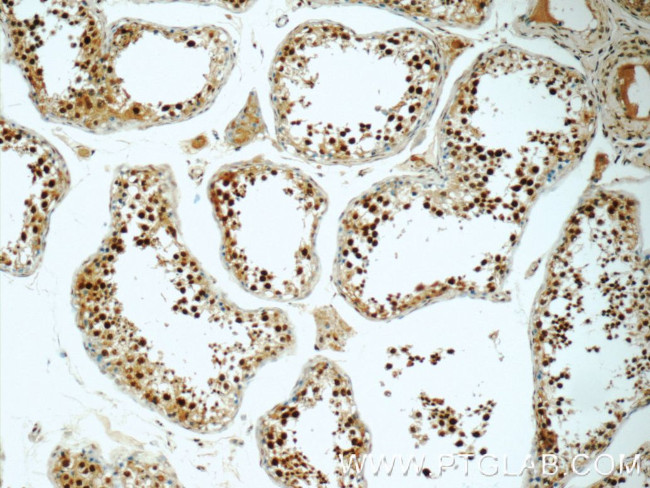 HIC1 Antibody in Immunohistochemistry (Paraffin) (IHC (P))