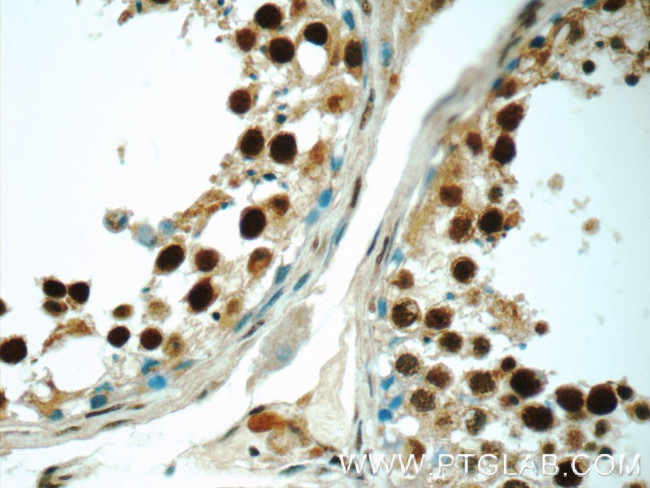 HIC1 Antibody in Immunohistochemistry (Paraffin) (IHC (P))