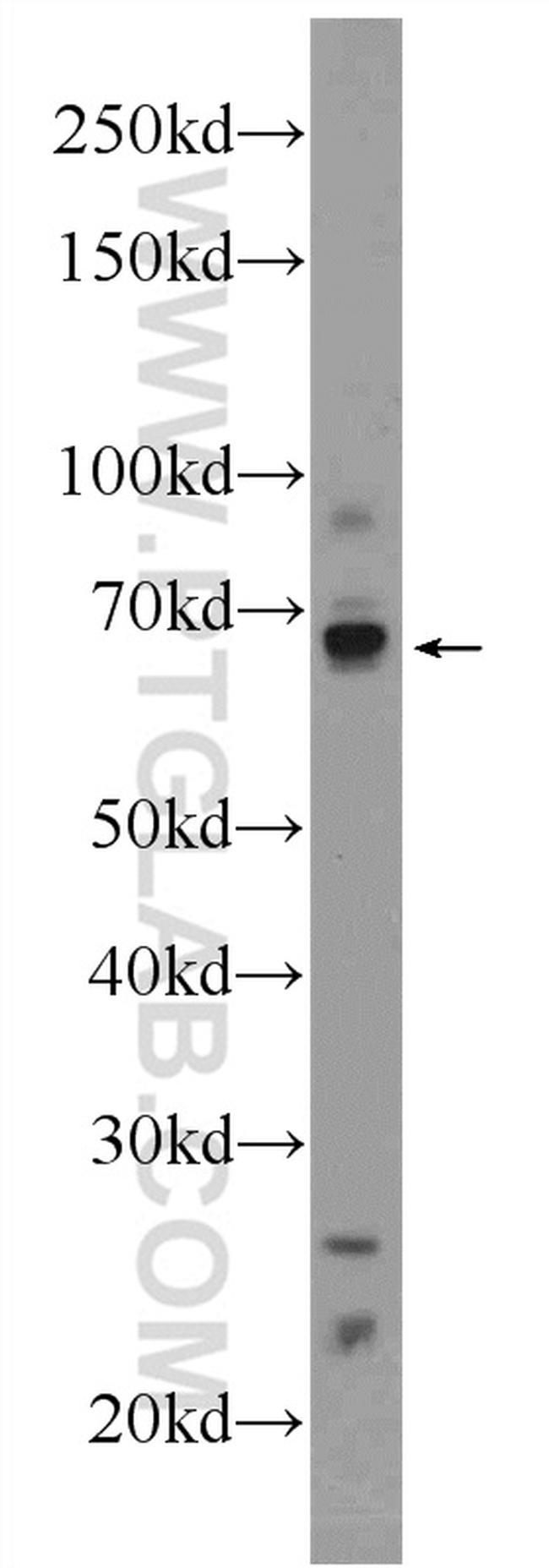 HIC1 Antibody in Western Blot (WB)