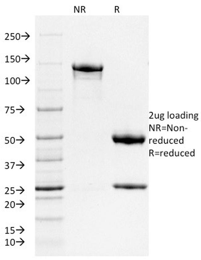 Ferritin, Heavy Chain (FTH) Antibody in SDS-PAGE (SDS-PAGE)