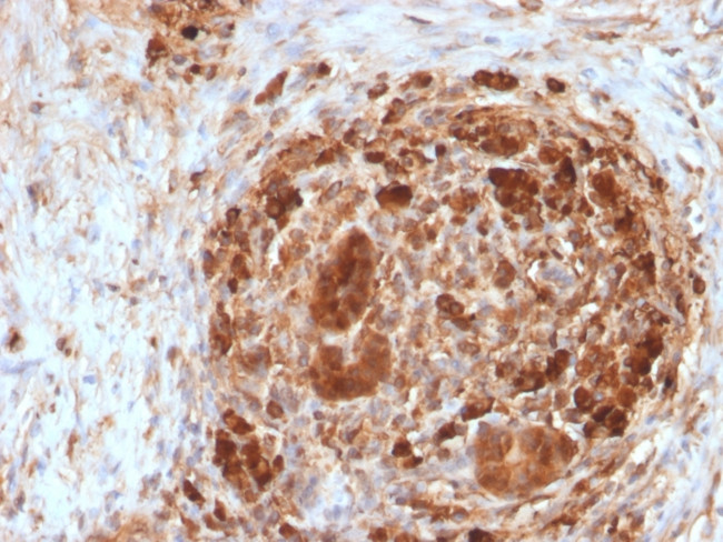 Ferritin, Heavy Chain (FTH) Antibody in Immunohistochemistry (Paraffin) (IHC (P))