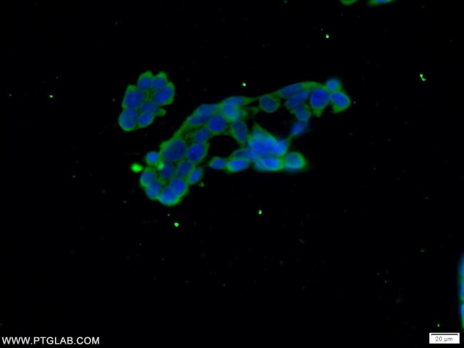 C10orf68 Antibody in Immunocytochemistry (ICC/IF)