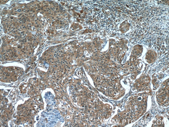 C10orf68 Antibody in Immunohistochemistry (Paraffin) (IHC (P))