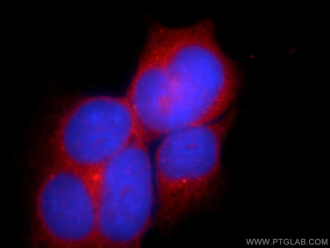 C10orf68 Antibody in Immunocytochemistry (ICC/IF)