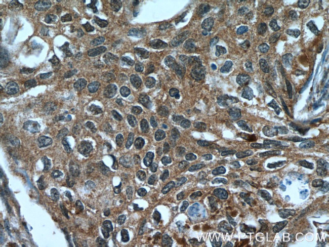 C10orf68 Antibody in Immunohistochemistry (Paraffin) (IHC (P))