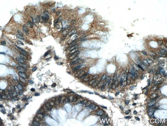 C10orf68 Antibody in Immunohistochemistry (Paraffin) (IHC (P))