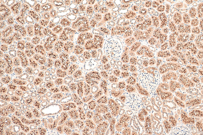 C10orf68 Antibody in Immunohistochemistry (Paraffin) (IHC (P))