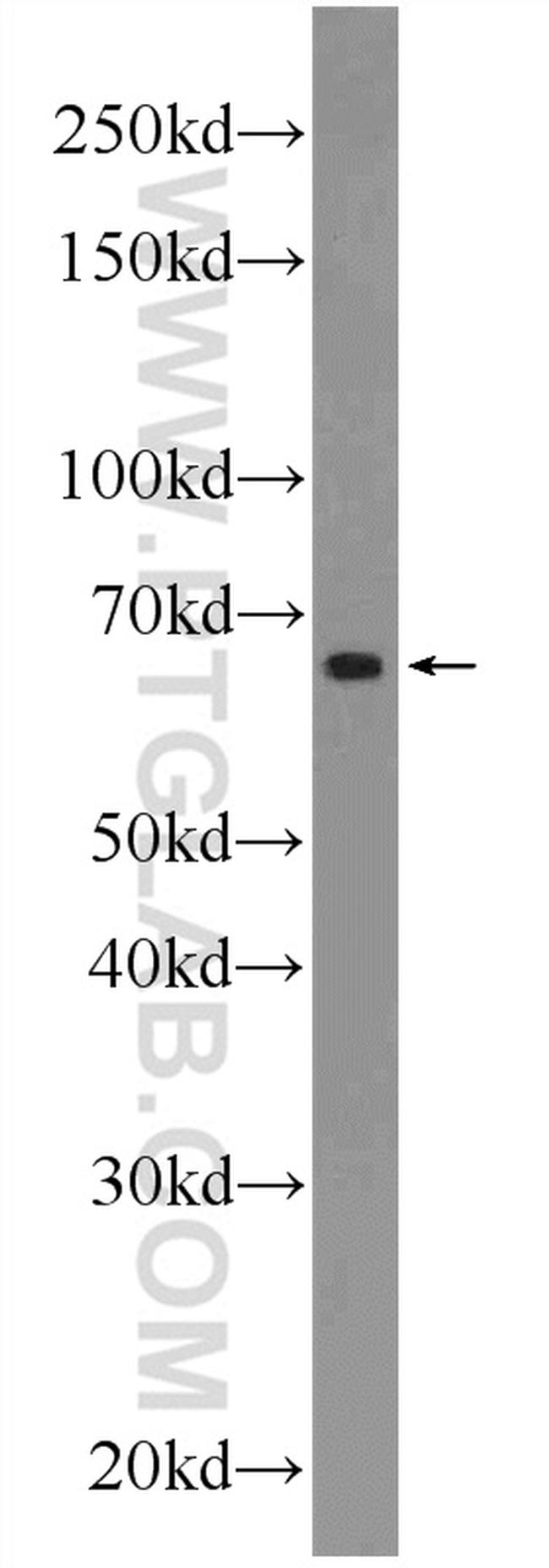 C10orf68 Antibody in Western Blot (WB)