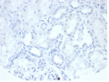 Alkaline Phosphatase (Placental)/PLAP (Germ Cell Tumor Marker) Monoclonal  Antibody (rALP/870) (250-MSM7-P1)